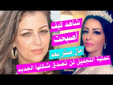 شاهد تغيير أمال صقر بشكل لا يصدق