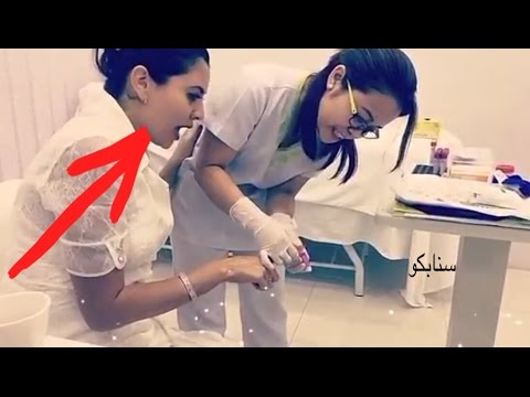 رد فعل فنانة عراقية لحظة سحب عينة دم من إصبعها