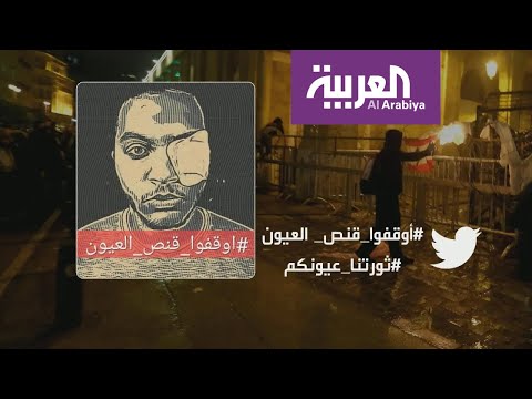 شاهد ناشطون لبنانيون يغطون عينهم تضامنا ما شاب فقد عينه في مواجهات بيروت