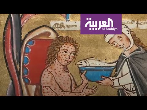 مرض مرعب ضرب العالم أشد من كورونا