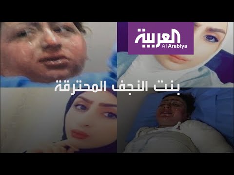 فتاة عراقية تحرق نفسها وعائلتها اتهمت زوجها بعتنيفها