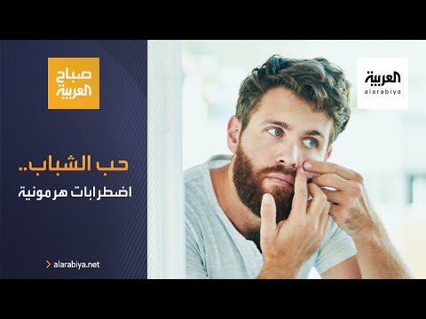 الاضطرابات الهرمونية تلعب دورًا كبيرا في ظهور حب الشباب